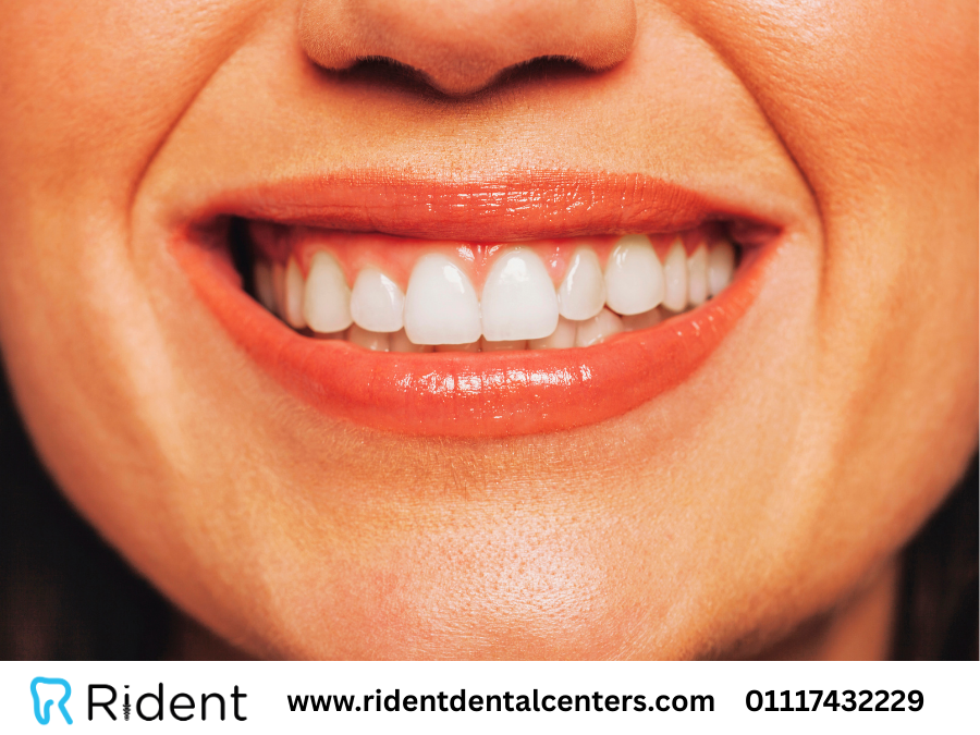 أهم 6 أسئلة وإجابات عن شكل الاسنان الطبيعي