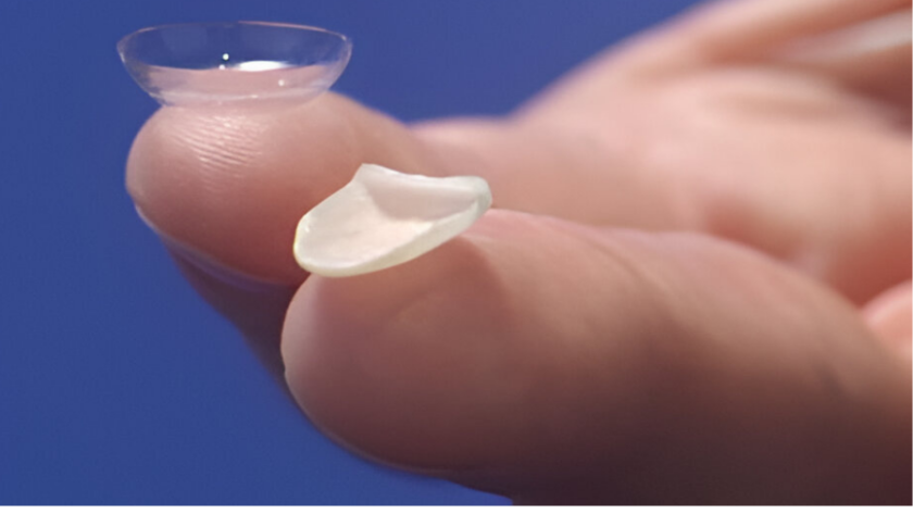 الفرق بين الفينير واللومينير