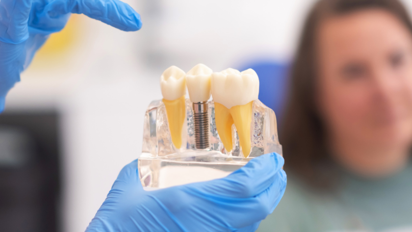 بدائل زراعة الأسنان وهل يفقد الناس أسنانهم بسبب داء السكري؟