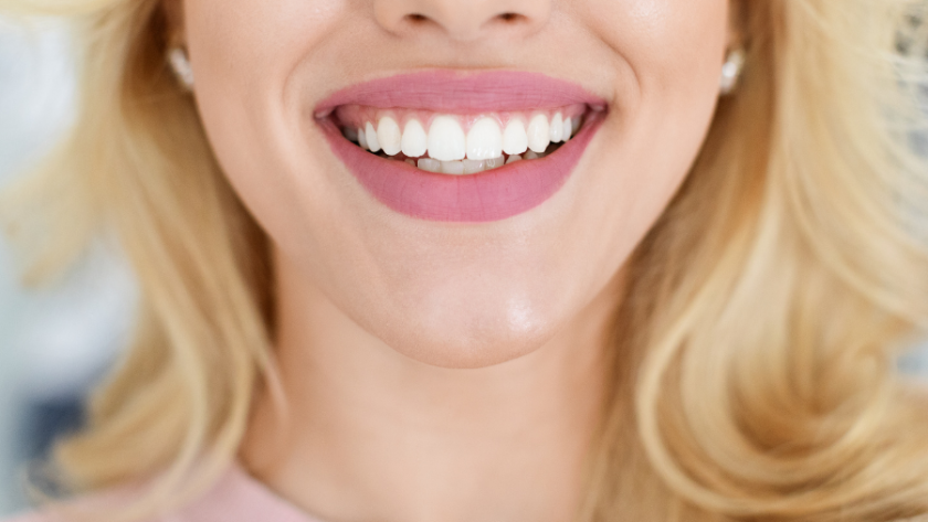 تجميل الاسنان 