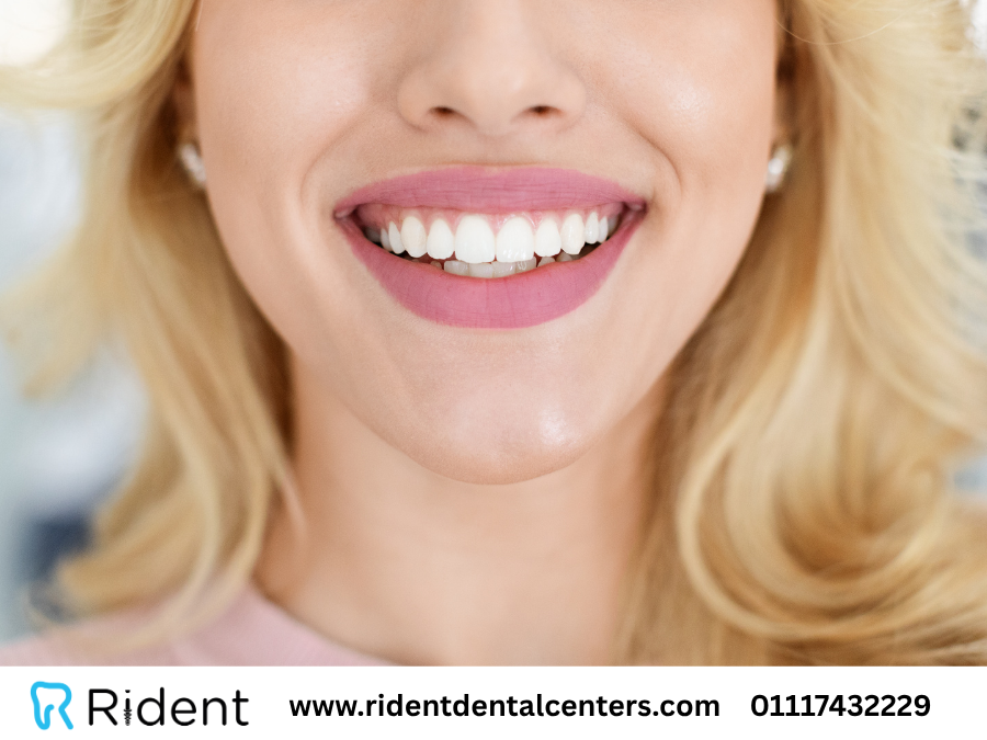 تجميل الاسنان 