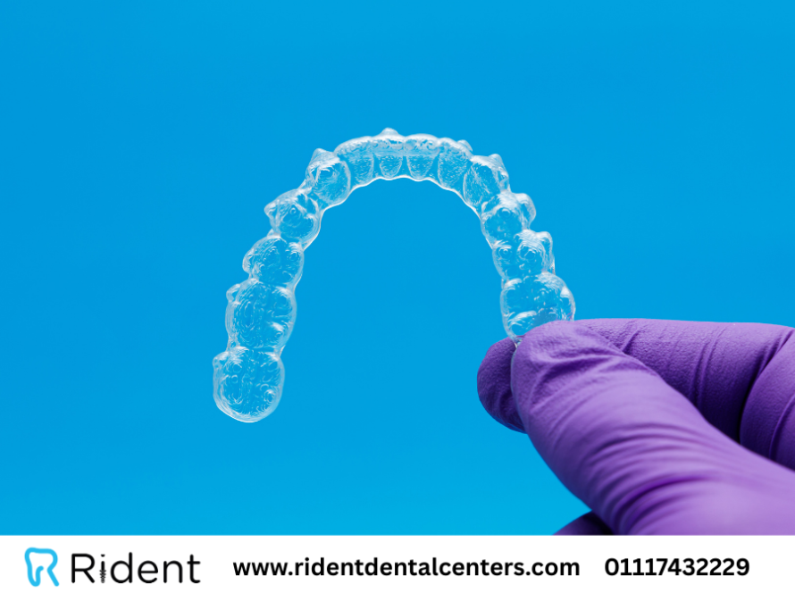 تقويم الاسنان المتحرك