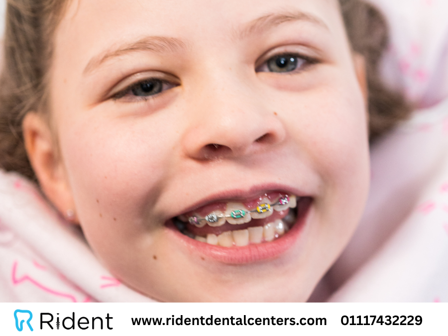 تقويم الاسنان للاطفال