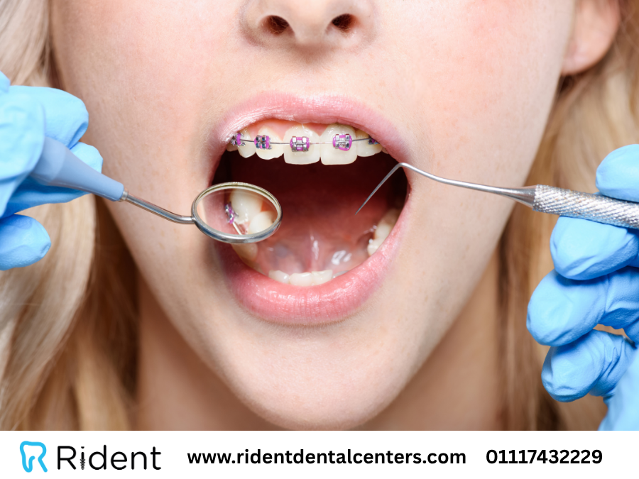 هل يمكن زراعة اسنان بدون ألم؟ و7 نصائح ذهبية