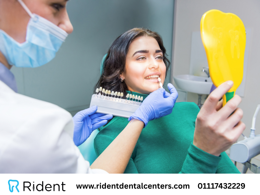 هل الفينير يحتاج إلى برد الأسنان؟ الإجابة في 70 ثانية