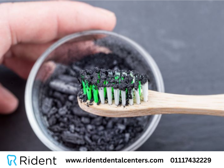 هل يساهم تنظيف الاسنان بالفحم في تبييض الأسنان؟
