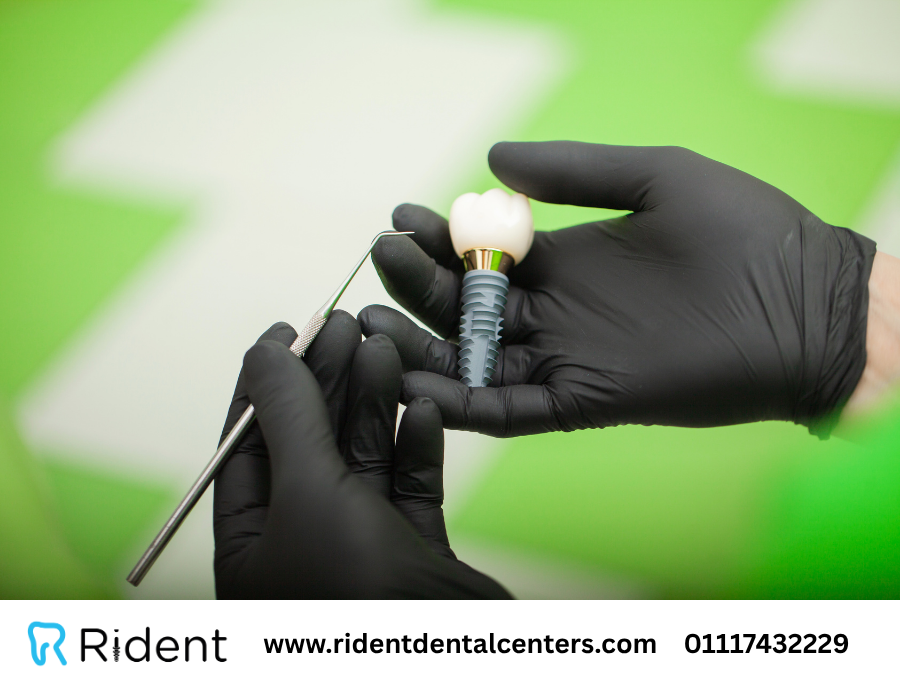 هل يمكن زراعة الاسنان لمرضى السكر؟